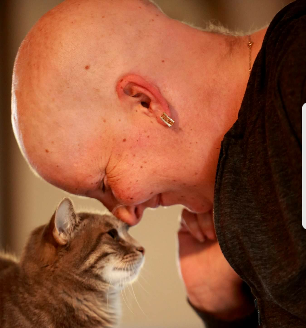 Sa maladie ravage son portefeuille