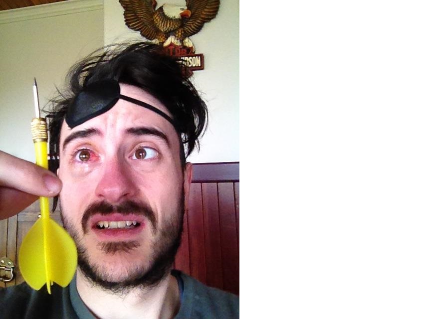 En soutien à Mike Ward avec un look de pirate : Joe le mécano a failli perdre son œil droit