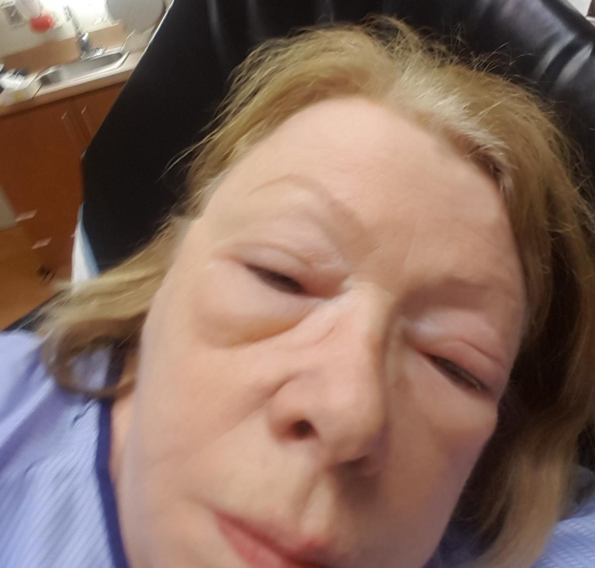 Huit doses d’EpiPen pour lui sauver la vie