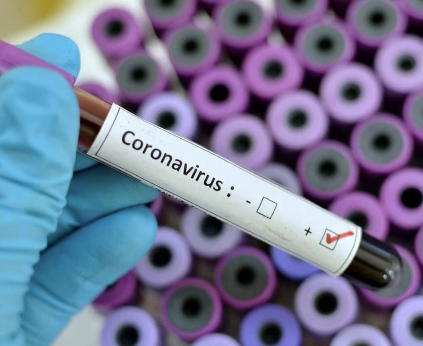 Image illustrant l'article: Près de 170 cas de COVID-19 recensés en une semaine dans la MRC de Roussillon